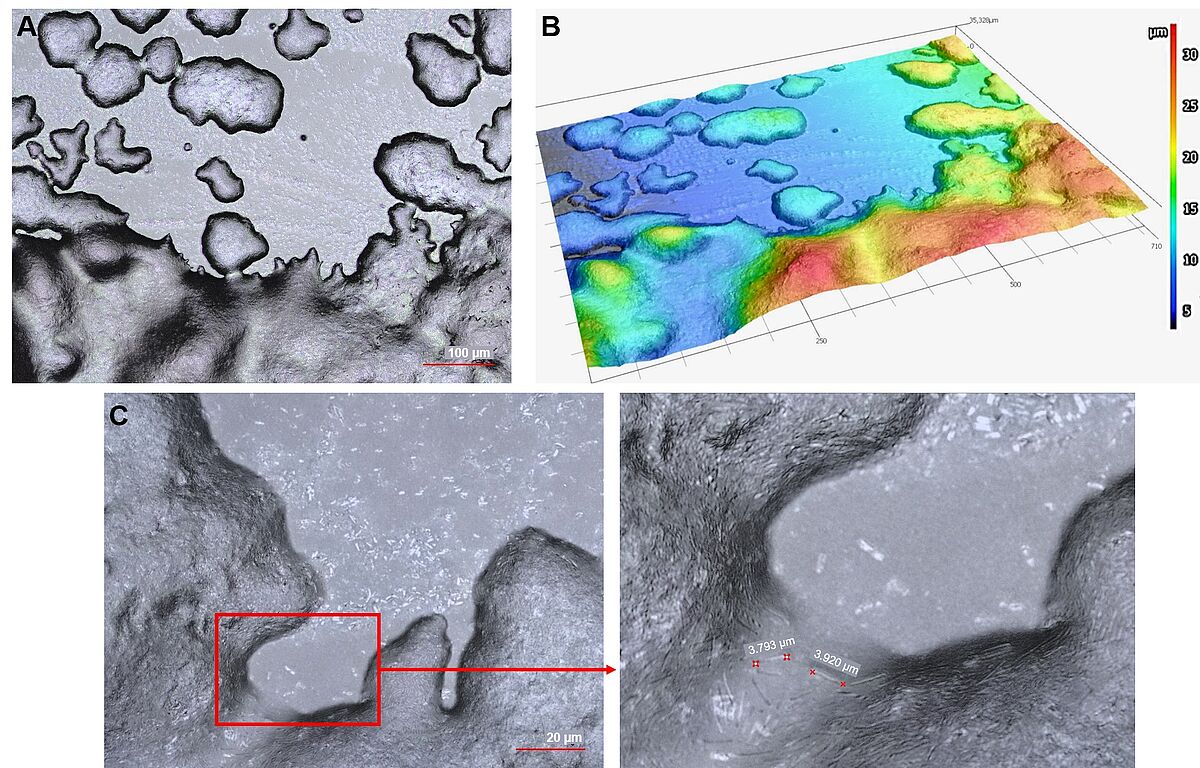 Laser scanning microscopy of bacterial lysis